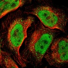 Immunofluorescent staining of human cell line U-2 OS shows localization to nucleoplasm & vesicles.