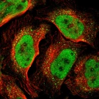 Immunofluorescent staining of human cell line U-2 OS shows localization to nucleoplasm & vesicles.