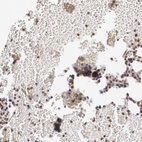Immunohistochemical staining of human bone marrow shows high expression.