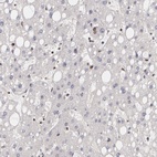 Immunohistochemical staining of human liver shows low expression as expected.