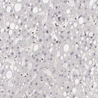 Immunohistochemical staining of human liver shows low expression as expected.