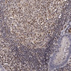 Anti-ELK3 Antibody