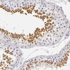 Immunohistochemical staining of human testis shows moderate cytoplasmic positivity in cells in seminiferous ducts.