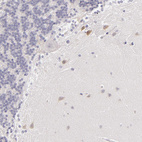 Anti-FAM181A Antibody