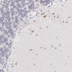 Immunohistochemical staining of human cerebellum shows weak cytoplasmic positivity in neurons.