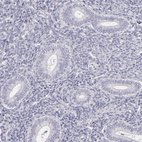 Anti-FAM181A Antibody