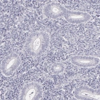 Immunohistochemical staining of human endometrium shows no positivity in glandular cells as expected.