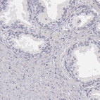 Immunohistochemical staining of human prostate shows no positivity in glandular cells as expected.