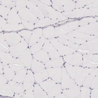 Immunohistochemical staining of human skeletal muscle shows no cytoplasmic positivity in myocytes as expected.