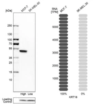 Western blot analysis in human cell lines MCF-7 and SK-MEL-30 using Anti-KRT18 antibody. Corresponding KRT18 RNA-seq data are presented for the same cell lines. Loading control: Anti-PFN1.