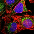 Immunofluorescent staining of human cell line U-2 OS shows localization to cytosol.