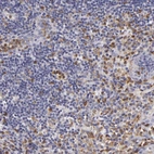 Immunohistochemical staining of human appendix shows high expression.