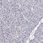 Anti-TLR8 Antibody