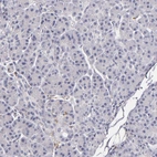 Immunohistochemical staining of human pancreas shows low expression as expected.