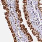 Anti-HNRNPA1 Antibody