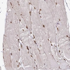 Immunohistochemical staining of human skeletal muscle shows strong nuclear positivity in myocytes.