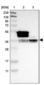 Lane 1: Marker [kDa] 230, 130, 95, 72, 56, 36, 28, 17, 11_br/_Lane 2: Human cell line RT-4_br/_Lane 3: Human cell line U-251MG sp