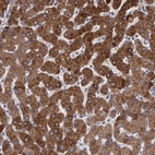 Anti-PON1 Antibody