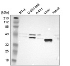 Western blot analysis in human cell line RT-4, human cell line U-251 MG, human cell line A-431, human liver tissue and human tonsil tissue.