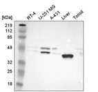 Western blot analysis in human cell line RT-4, human cell line U-251 MG, human cell line A-431, human liver tissue and human tonsil tissue.
