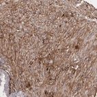 Immunohistochemical staining of human prostate shows moderate cytoplasmic positivity in smooth muscle cells.