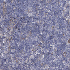 Anti-FBLN1 Antibody