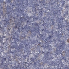 Immunohistochemical staining of human lymph node shows very weak cytoplasmic positivity in non-germinal center cells.