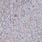 Immunohistochemical staining of human liver shows very weak cytoplasmic positivity in hepatocytes.