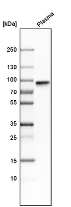 Western blot analysis in human plasma.