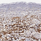 Immunohistochemical staining of human skin shows strong positivity in extracellular matrix.