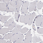 Anti-FBLN1 Antibody