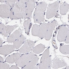 Immunohistochemical staining of human skeletal muscle shows no positivity in myocytes as expected.