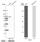 Western blot analysis in human cell lines HeLa and SK-MEL-30 using Anti-FBLN1 antibody. Corresponding FBLN1 RNA-seq data are presented for the same cell lines. Loading control: Anti-COX4I1.
