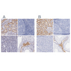 Anti-KNG1 Antibody