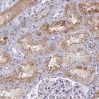 Immunohistochemical staining of human kidney shows strong granular cytoplasmic positivity in cells in tubules.