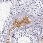 Immunohistochemical staining of human testis shows strong positivity in plasma.