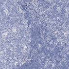 Anti-KNG1 Antibody