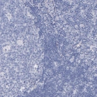 Immunohistochemical staining of human lymph node shows no positivity in non-germinal center cells as expected.