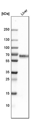 Western blot analysis in human liver tissue.