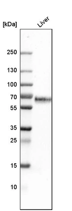 Western blot analysis in human liver tissue.