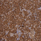 Anti-RIOK3 Antibody