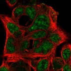 Immunofluorescent staining of human cell line HEK 293 shows localization to nucleoplasm.