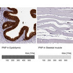 Anti-PNP Antibody