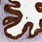Immunohistochemical staining of human epididymis shows strong cytoplasmic positivity in glandular cells.