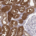Immunohistochemical staining of human kidney shows strong cytoplasmic positivity in cells in tubules.