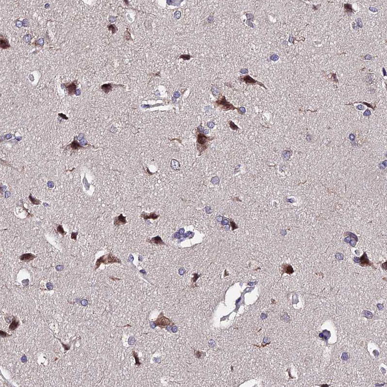 Anti-INPP4A Antibody