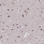 Anti-INPP4A Antibody