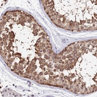 Immunohistochemical staining of human testis shows strong nuclear and cytoplasmic positivity in cells in seminiferous ducts.