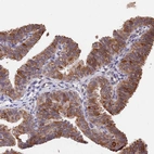 Immunohistochemical staining of human fallopian tube shows strong nuclear and cytoplasmic positivity in glandular cells.