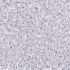 Immunohistochemical staining of human liver shows no positivity in hepatocytes as expected.